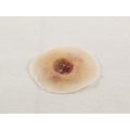 Moulage Science & Training Gunshot Entry Wound, Light, PK 18 MST-01-02-18